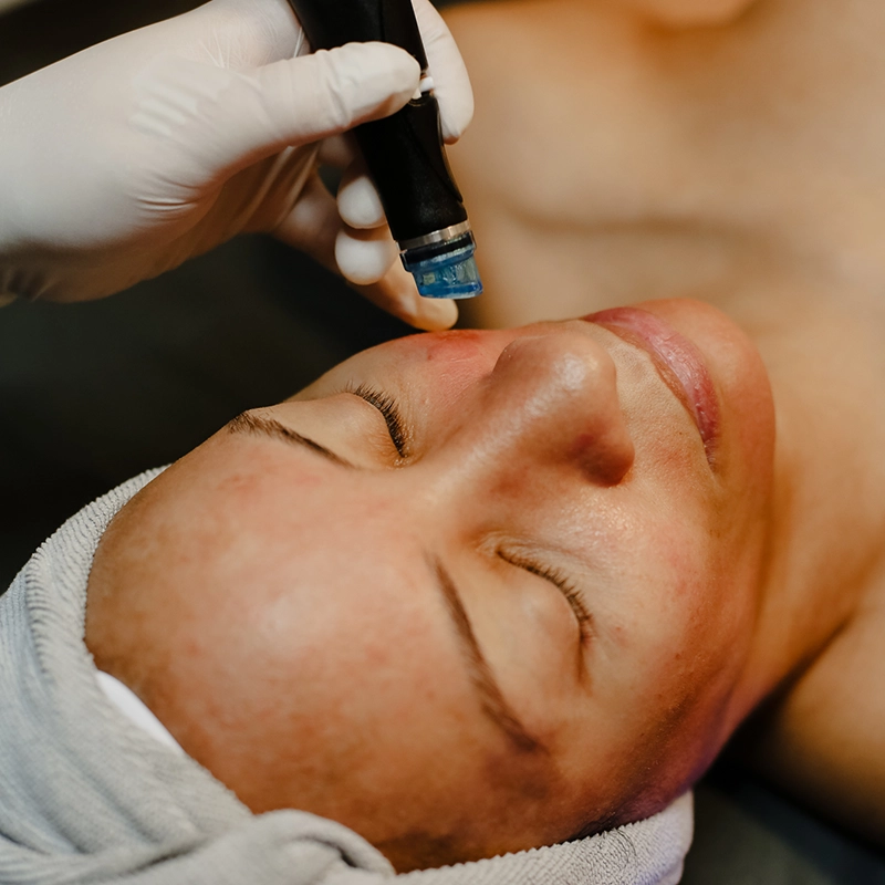 Hydrafacial at Natural Body Spa & SkinReMEDI