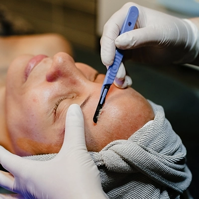 dermaplaning