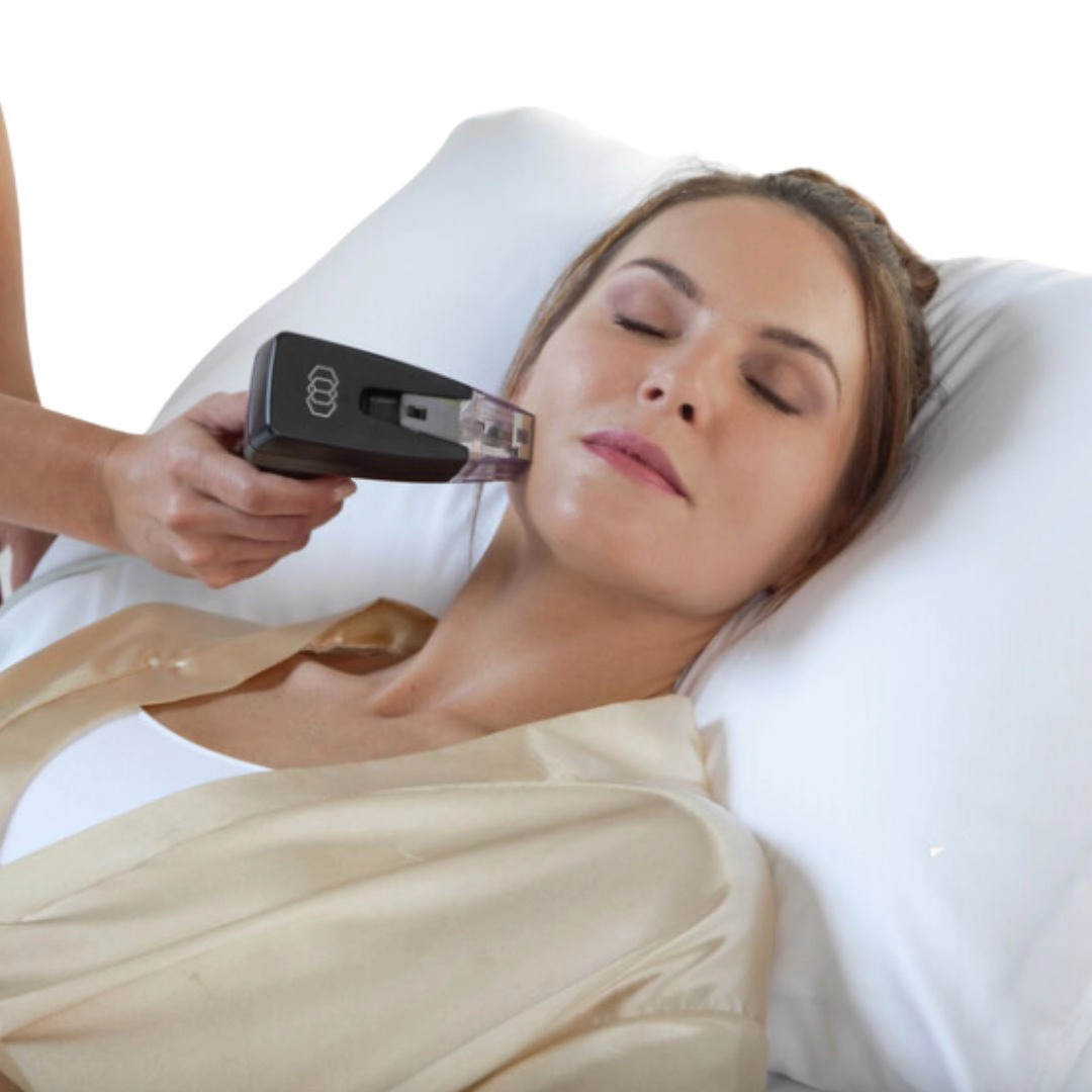 Morpheus8 RF Microneedling