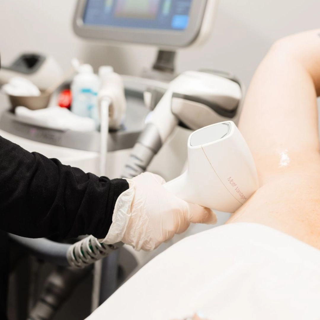 DiolazeXL Laser Hair Removal
