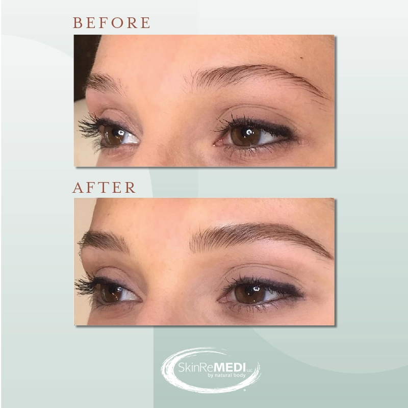 Microblading Brows before and after Natural Body Spa & SkinReMEDI Morningside