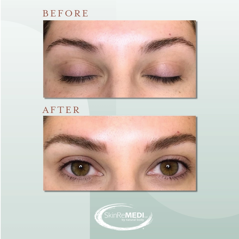 Microblading Lashes before and after Natural Body Spa & SkinReMEDI Morningside