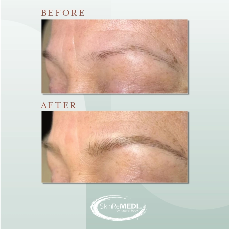 Microblading Brows before and after Natural Body Spa & SkinReMEDI Morningside