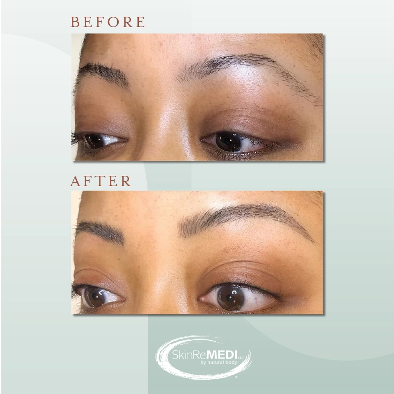 Microblading lashes before and after Natural Body Spa & SkinReMEDI Morningside